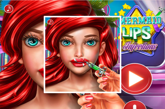 Ariel Lips Injections
